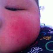 三个多月宝宝脸蛋经常红红的，脸蛋肉硬，怎么回事,三个多月胎儿图片有多大