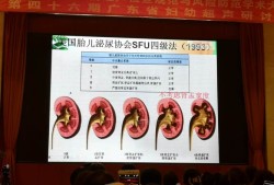 胎儿双肾盂增宽（胎儿双肾盂增宽是什么意思）
