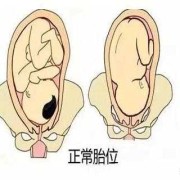 孕30周，胎儿头位低是什么意思呢，有什么影响,胎儿头太低有什么影响