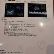 怀孕35周了，胎儿偏小怎么办,35周胎儿偏小怎么补救