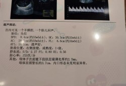 怀孕35周了，胎儿偏小怎么办,35周胎儿偏小怎么补救