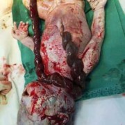 引产时胎儿为什么会死（20 小牛犊死在大牛肚子里该怎么办）
