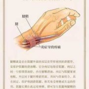 孕期腱鞘炎怎么办,孕期腱鞘炎怎么治疗最好最有效