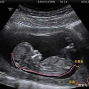 孕12周头臀径47mm正常吗,十二周的胎儿有多大图片