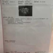 产假45天怎么办,孕期45天可以有胎心吗
