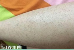 孕期体毛变少已知是男（男性彻底女性化后会变成女生吗）
