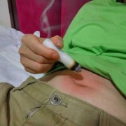 怀孕艾灸肚子对胎儿有什么影响（艾灸后才发现怀孕了有影响吗）