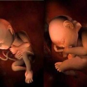 34周胎儿在肚子里是什么样子的呢,胎儿在腹腔里能不能存活
