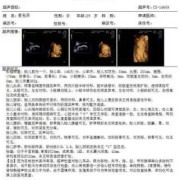 胎儿四维彩超多少钱（胎儿四维彩超多少钱一次）