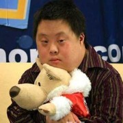 唐氏胎儿的症状（唐氏儿胎儿时的症状）