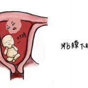 孕期出现子宫肌瘤（孕期出现子宫肌瘤怎么办）