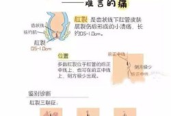肛裂能怀孕吗,孕期肛裂怎么办每次拉屎都出血