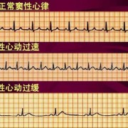 孕妇窦性心律过速110是不是属于正常的啊,孕期窦性心律过速对胎儿有影响吗