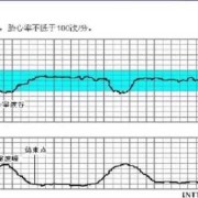胎儿心率过高（胎心监护心率过高原因都有哪些了的啊）