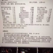 胎儿AF（胎儿af是什么意思）
