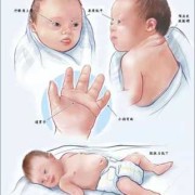 智障胎儿孕期特征（宝宝轻度弱智的表现是什么）