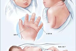 智障胎儿孕期特征（宝宝轻度弱智的表现是什么）
