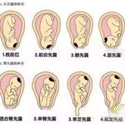 七个月胎儿胎位（七个月胎儿胎位头朝上正常吗）
