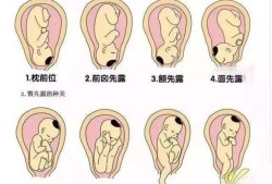 七个月胎儿胎位（七个月胎儿胎位头朝上正常吗）