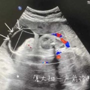 怀孕3个月胎儿图（怀孕3个月，能练车吗？对宝宝有影响吗）