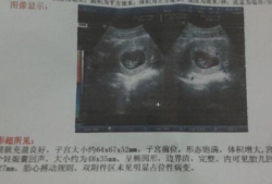 我怀孕38周了胎儿双顶径9.0厘米正常吗,9个月的胎儿发育标准是多少