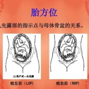 胎儿在母体的位置（胎儿在母体的位置图片）