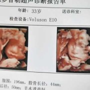 四维胎儿不配合（四维胎儿不配合）