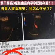孕期B超标准数据（为什么怀孕实际天数跟B超不一样）