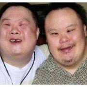 唐氏胎儿偏小（唐氏儿孕周偏小）