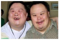 唐氏胎儿偏小（唐氏儿孕周偏小）