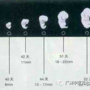 胎儿对外界声音无反应会不会是听力原因,声音很大胎儿也不动是不是胎儿听力有问题