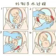 35周臀位胎儿图（35周臀位胎儿图片真实）