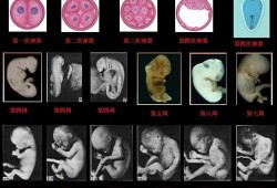 胎儿胎心慢是什么原因（胚胎发育慢怎么回事）