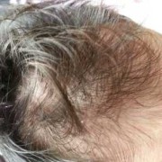 宝宝后面的头发长不出来怎么办,怀孕吃什么胎儿长头发