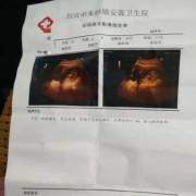怀孕8个月长时间坐着好吗,孕妇一天坐10小时要紧吗