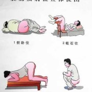 备孕一定要割痔疮吗,备孕期痔疮犯了怎么办