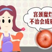 宫颈糜烂孕期（子宫颈糜烂怎么治疗）