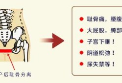 孕妇盆骨痛是什么原因,孕期骨盆疼痛如何缓解