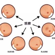 孕期乳腺纤维瘤（有乳腺纤维瘤可以怀孕吗）