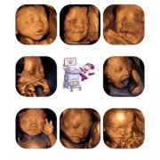 孕期二级筛查（孕妇28周到32周做二级四维彩超主要检查胎儿什么）
