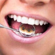 孕期牙齿酸是怎么回事（补牙后牙酸怎么回事）