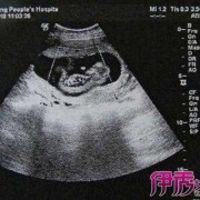 39周胎儿图男孩（39周胎儿图男孩数据）