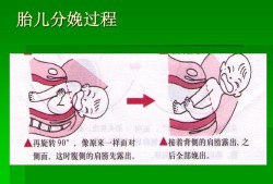 分娩是胎儿（分娩是胎儿）
