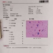染色体异常如何检查,查胎儿染色体怎么查的