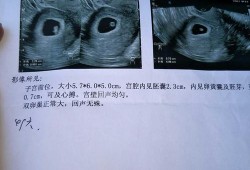孕期几周有胎心胎芽（孕期几周有胎心胎芽正常）