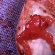 70天胎儿的真实照片（70天的孕囊图片）