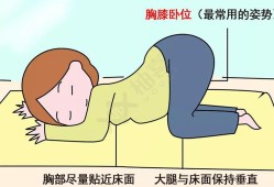 胎儿仰卧位（宝宝怎么坐起来）