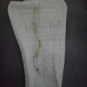 孕期灰色白带（孕期灰色白带）
