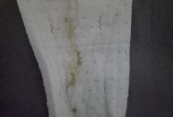 孕期灰色白带（孕期灰色白带）
