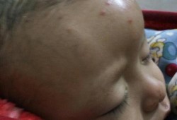 四个半月胎儿图片（四个多月的小孩从床上摔下来，头上起了一个包，有没有事）